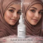 Before and after results using niacinamide 10% zinc 1% serum